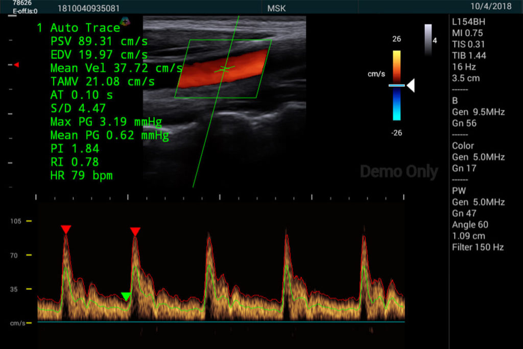 BenQ T3300 portable ultrasound - margpharma.com